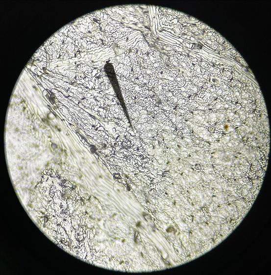 Urtica dioica leaf cross section micrograph.zip