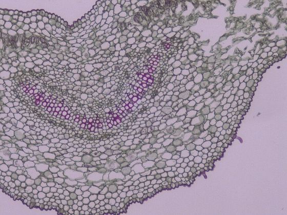 Xerophytic leaf micrograph