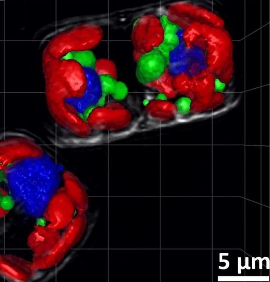 Fluorescence micrograph of Thalassiosira nanae